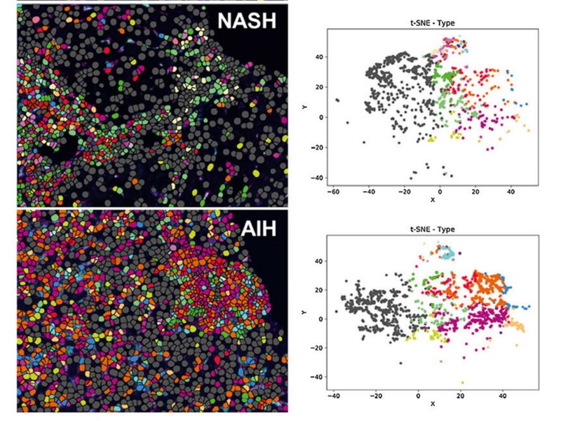 Visiopharm Multiplex Phenotyping Software