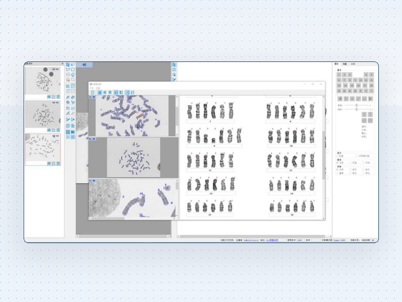 AI Karyotyping System